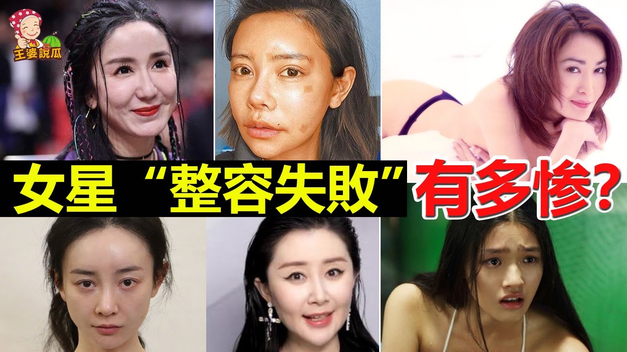 深度解析：整容很好看的女明星，如何做到自然美的典范？